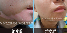 沿װ