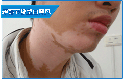 ڶͰ